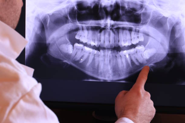 Best Emergency Broken Tooth Repair in Lock Haven, PA