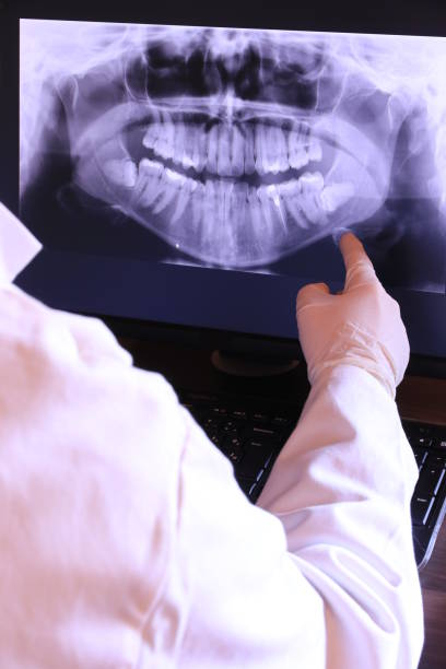 Best Emergency Tooth Extraction in Lock Haven, PA