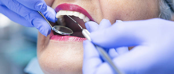 Best Emergency Wisdom Teeth Removal in Lock Haven, PA